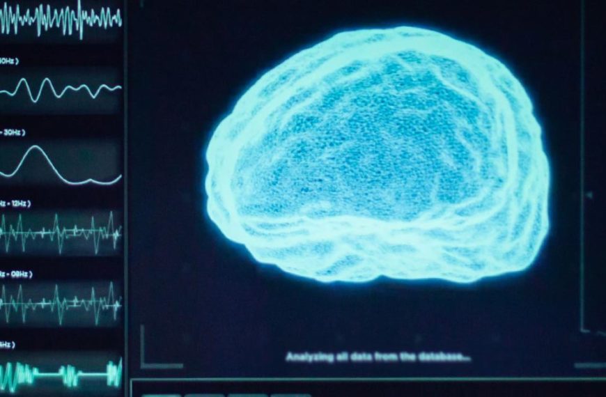 A monitor with an image of a brain on it.