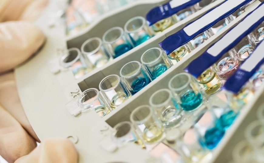 A person holding a test tube in a laboratory.
