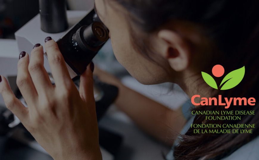 A woman looking through a microscope with the words canlyme on it.