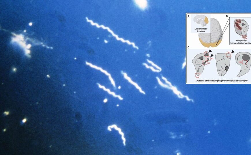 An image of a sea creature with a squid in the water alongside a Borrelia bacteria visualization.