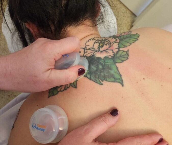Is Cupping & Gua Sha right for you? Some clinical FAQs