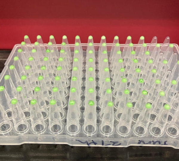 How biobanks are revolutionizing medical research — and why Canada needs one for Lyme disease