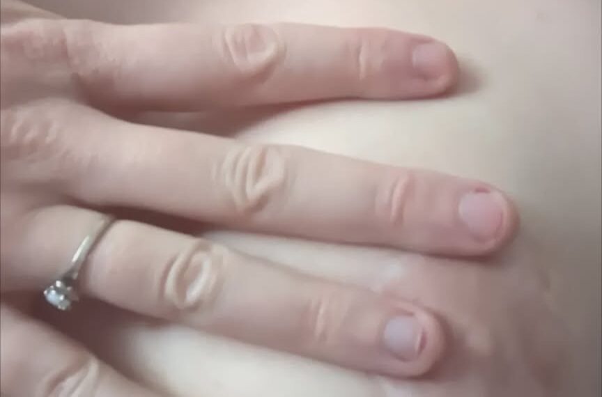 A hand with a ring rests on bare skin, showing close details of fingers and fingernails.
